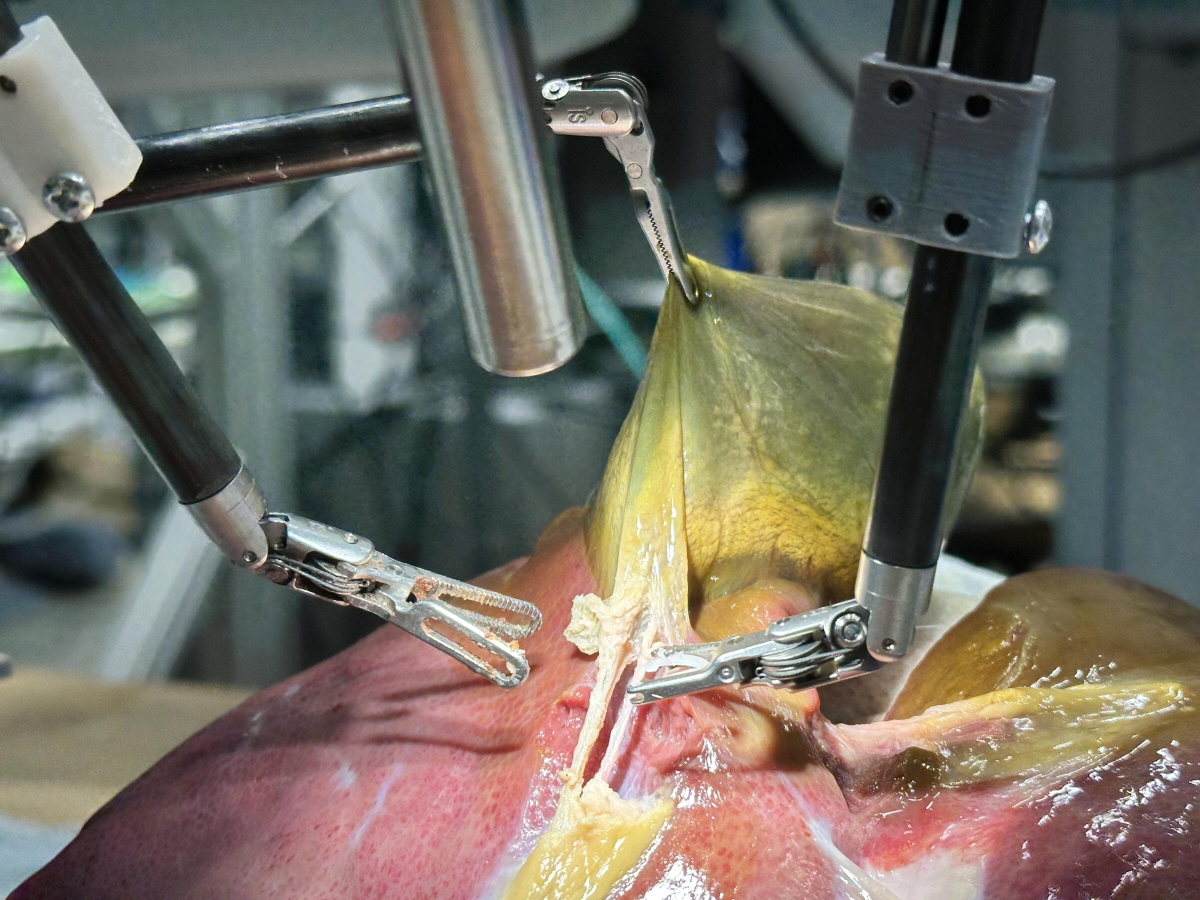 Un robot con inteligencia artificial realiza por primera vez una cirugía realista sin ayuda humana